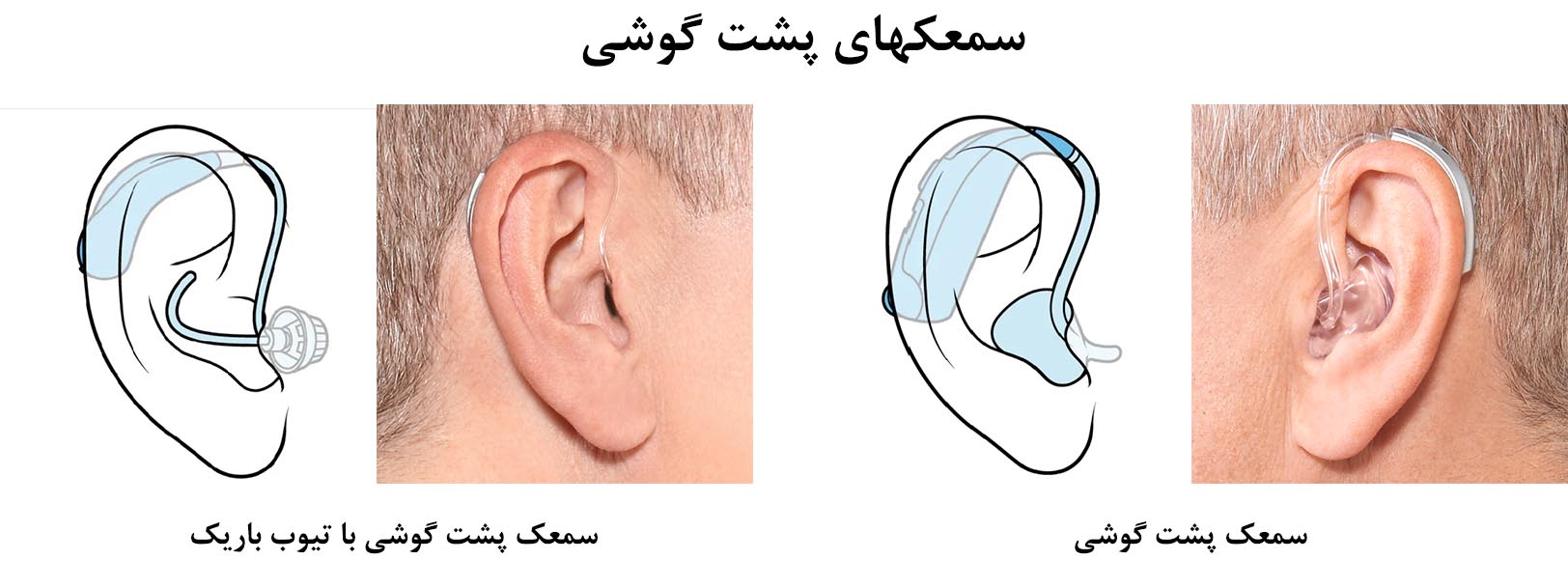 انواع سمعک